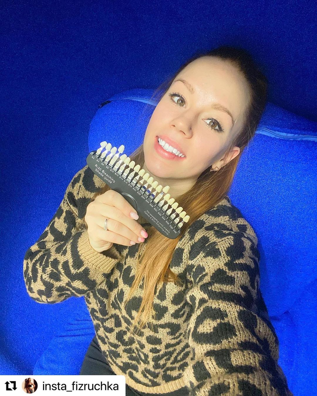 Отзыв на отбеливание зубов от @insta_fizruchka 16 декабря 2020 отзыв на отбеливание зубов от @insta_fizruchka