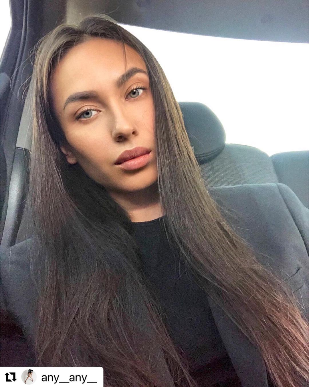 Отзыв на отбеливание зубов от @any__any__ 27 февраля 2021 отзыв на отбеливание зубов от @any__any__