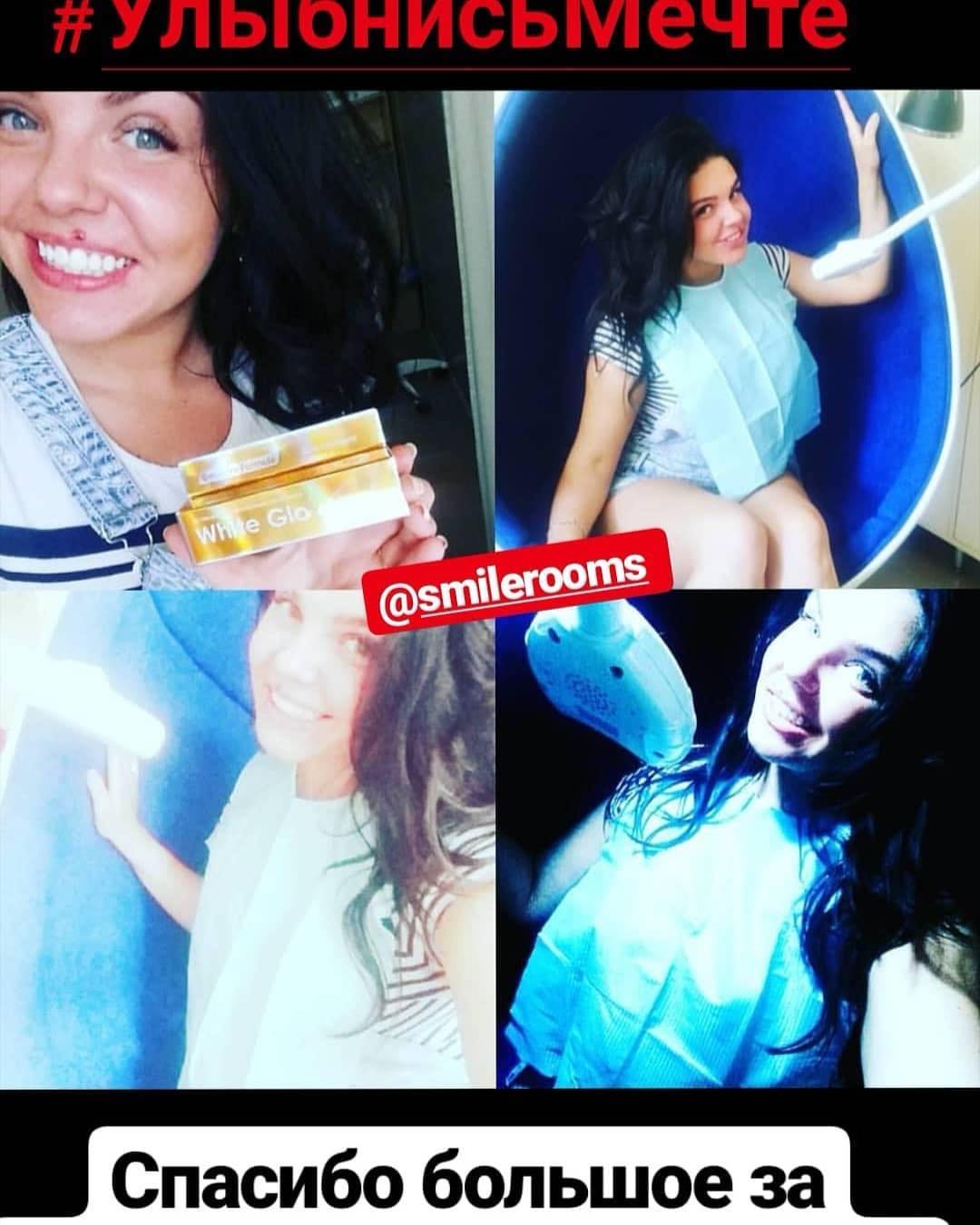 Отзыв на отбеливание зубов от @daaasha_1990 20 августа 2019 отзыв на отбеливание зубов от @daaasha_1990