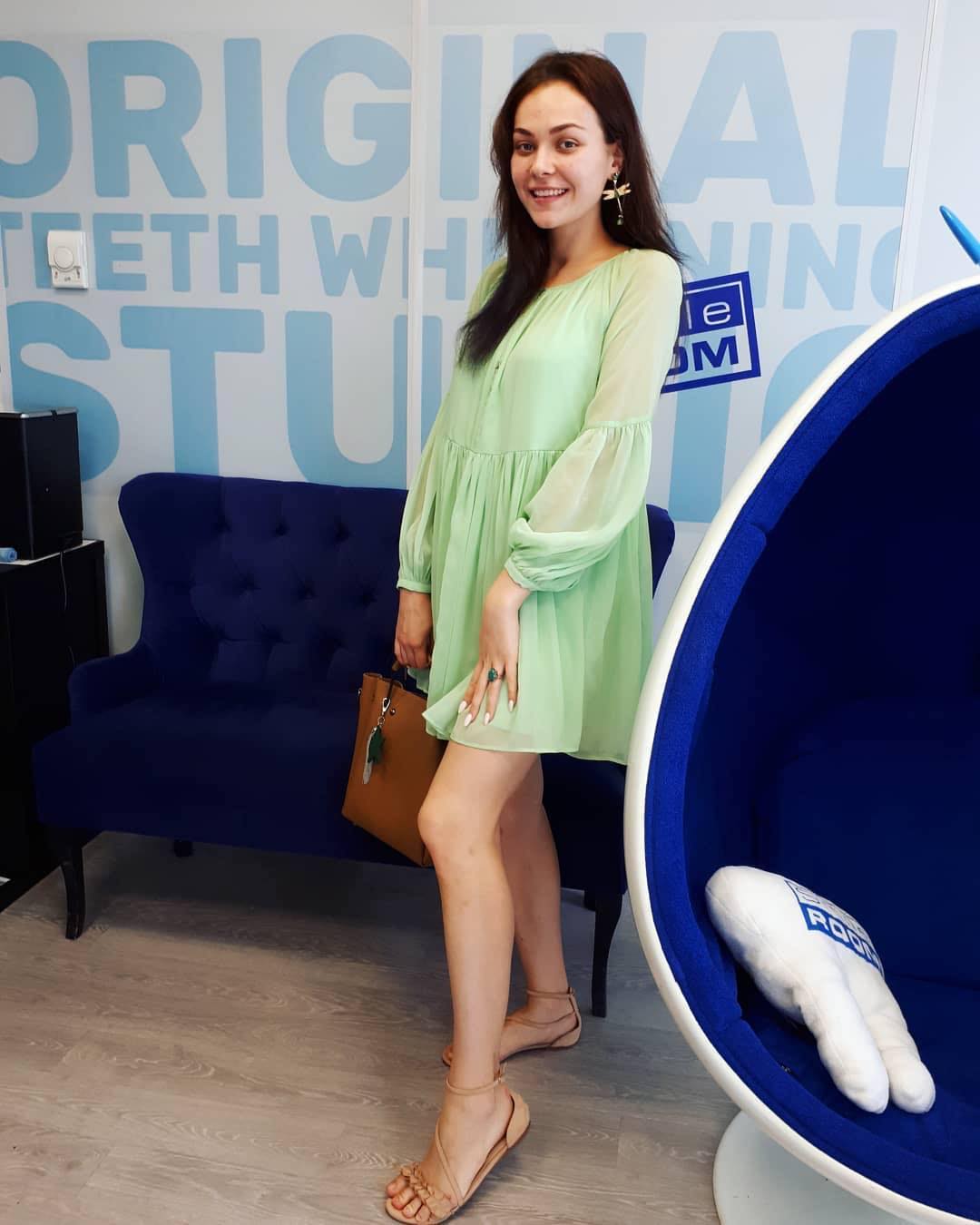 Отзыв на отбеливание зубов от @kse_ni_aa 22 августа 2019 отзыв на отбеливание зубов от @kse_ni_aa