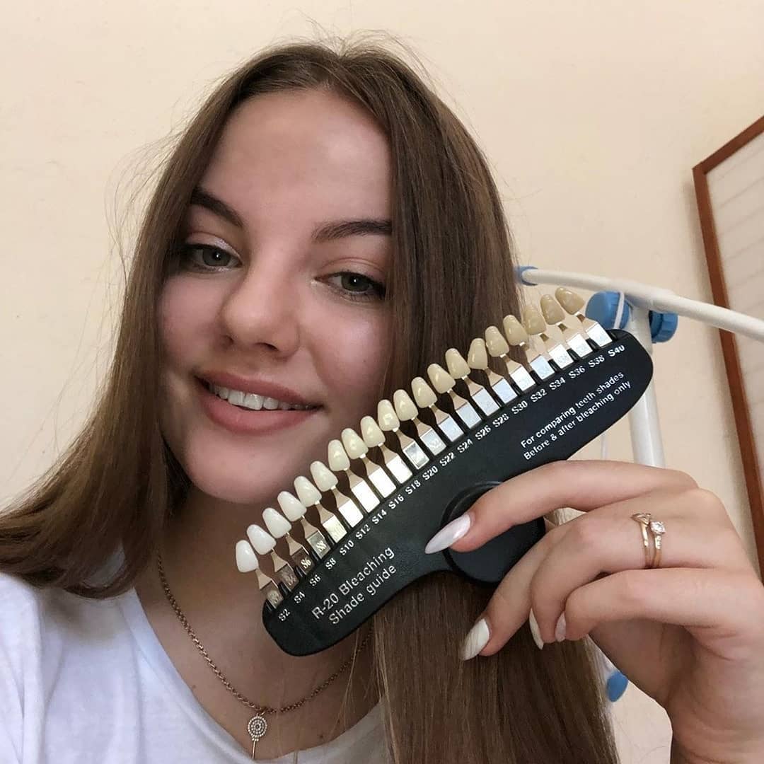 24 августа 2019 отзыв на отбеливание зубов от @livealenaa